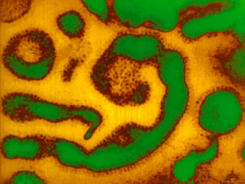 symptoms-of-the-common-cold-syndrome-are-caused-by-over-two-hundred-different-viruses